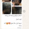 3bb5899a-995a-432e-a3b5-c376ee755073 propiderm.150m density solution