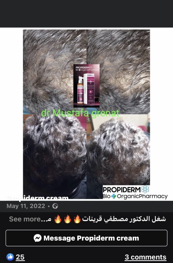 img_2609-2 propiderm.150m density solution