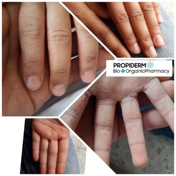 Propiderm cream 100ml