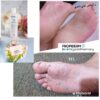 Propiderm cream 100ml
