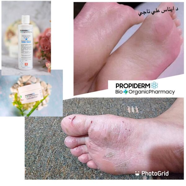 Propiderm cream 100ml