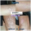 Propiderm cream 100ml