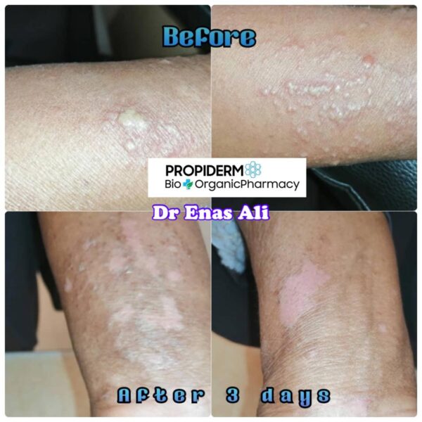 Propiderm cream 100ml