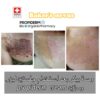 Propiderm cream 100ml