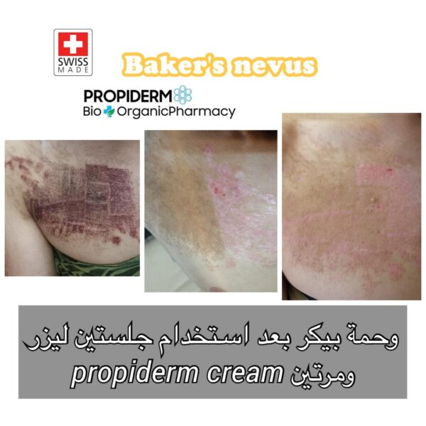 Propiderm cream 100ml