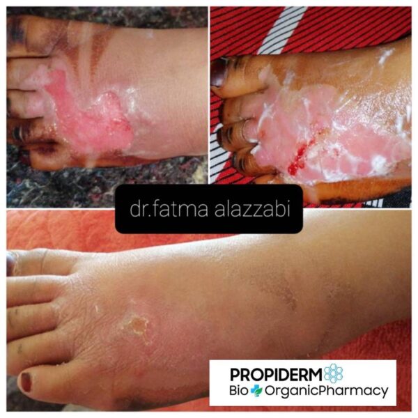 Propiderm cream 100ml