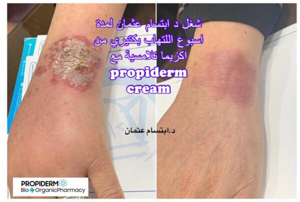 Propiderm cream 100ml