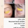 Propiderm cream 100ml