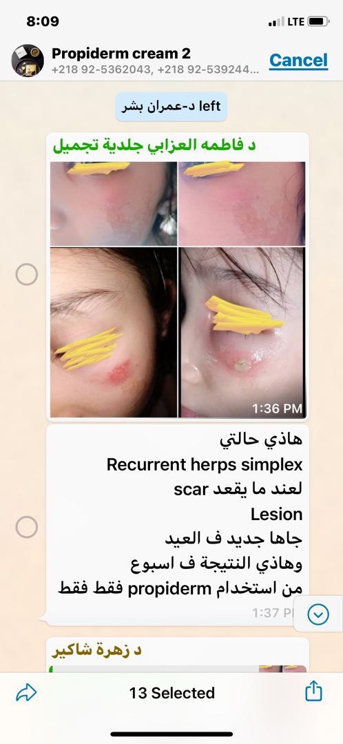 Propiderm cream 100ml
